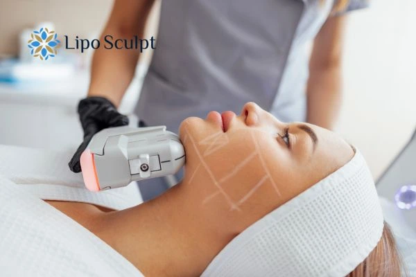 HIFU vs Botulinum Toxin: Understanding the Differences 1 HIFU vs Botox Goadby What is the best option for you?