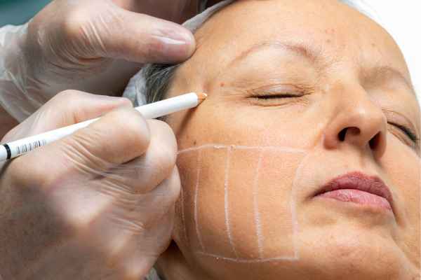 CryoPen: 5 Skin Concerns It May Be Used to Treat 4 What should you ask before having CryoPen treatment Goadby?