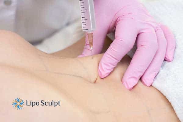 Aqualyx for Muffin Tops: What to Know Before Fat-Dissolving Injections 4 Are there risks Goadby?