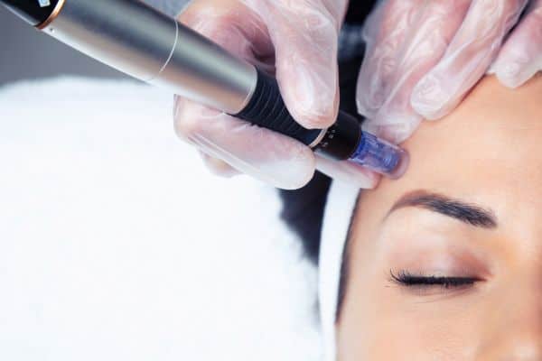 Explaining Total Skin Tightening Treatment and What to Expect 2 What Skin Concerns Can Total Skin Tightening Treatment Help With Goadby?